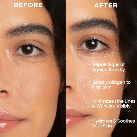 Hyphen 0.1% Retinal Reset Serum Pro | 30% More Effective Than Retinol Serum| Advanced Anti Ageing Face Serum | Boosts Collagen, Hydrates -30 Ml