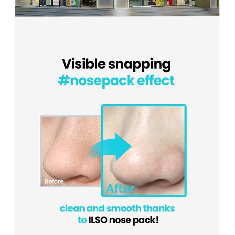 ilso Natural Mild Clear Nose Pack
