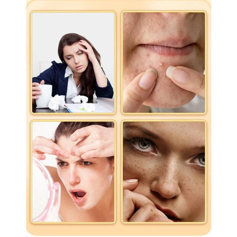 Rosa Roxburghii Rose Tea Healthy Herb Tea Bag 150g/5.29oz