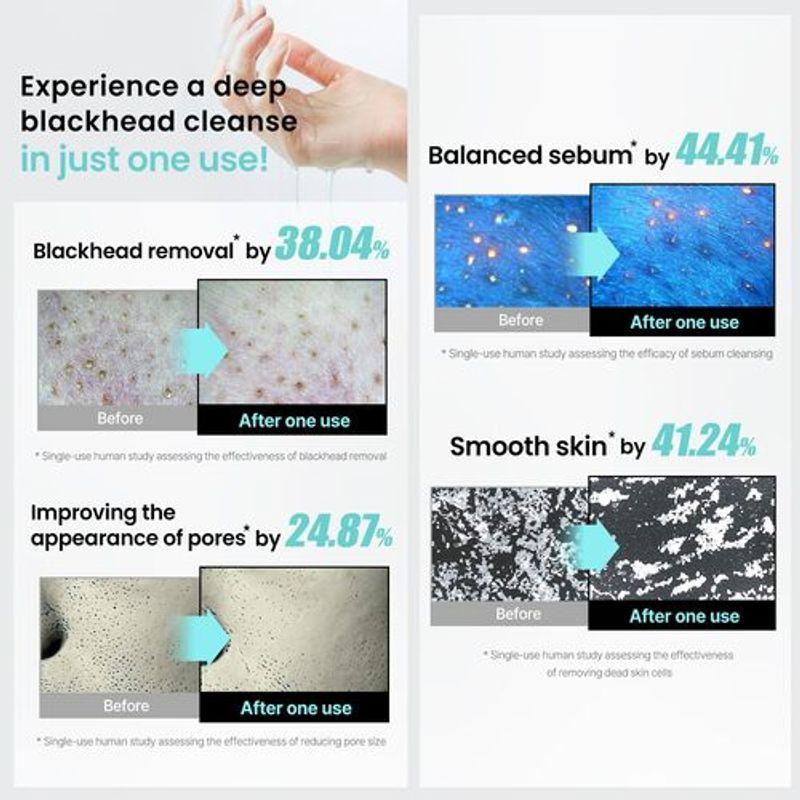 ilso Super Melting Sebum Cleansing Oil 200ml