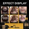 Hair Growth Serum with Biotin, Reduces Hair Loss, Nourishes Scalp & Strengthens Hair Follicles, Anti-Hair Fall Treatment for Men & Women, 60ml