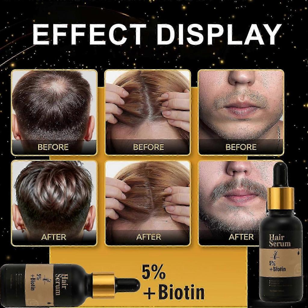 Hair Growth Serum with Biotin, Reduces Hair Loss, Nourishes Scalp & Strengthens Hair Follicles, Anti-Hair Fall Treatment for Men & Women, 60ml