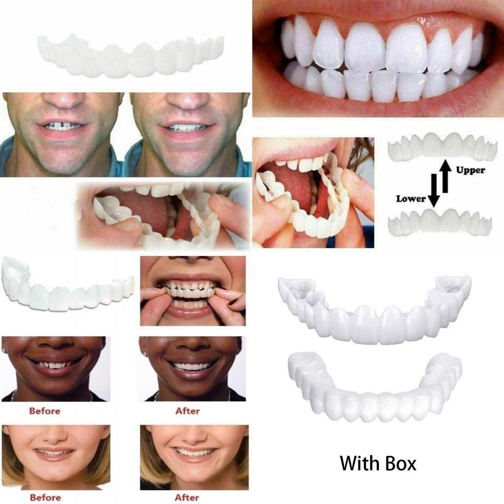 Fake Snap On Teeth Upper Lower Dental Veneers Denture Tooth Cover Set Simulation