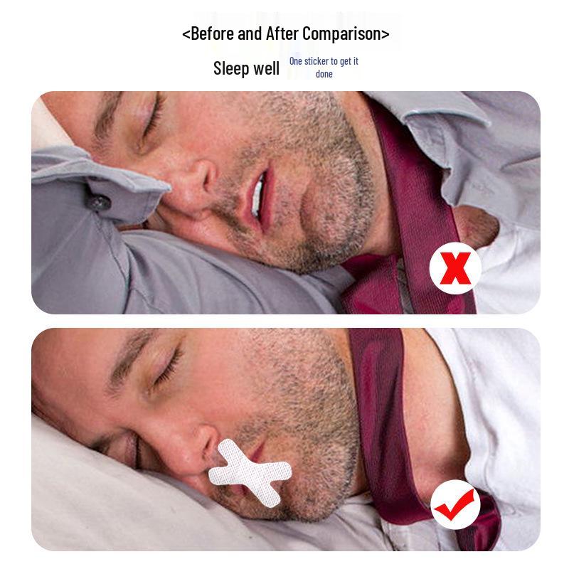X-Type Breathable Cotton Mouth Patch for Nighttime Mouth Closure
