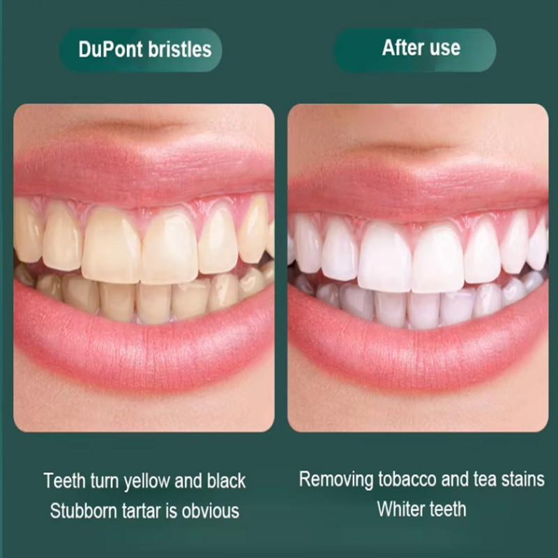 Professional Ultrasonic Electric Toothbrush With Nylon Brush Automatic Rechargeable Electric Toothbrush