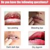 Eelhoe Moisturizing Brightening Lip Balm - Prevents Dryness And Peeling, Repairs Lips, Hydrates, Reduces Lip Lines