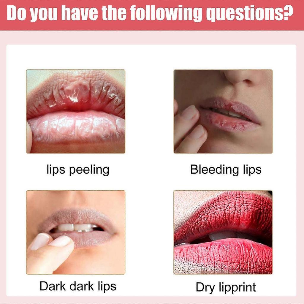Eelhoe Moisturizing Brightening Lip Balm - Prevents Dryness And Peeling, Repairs Lips, Hydrates, Reduces Lip Lines