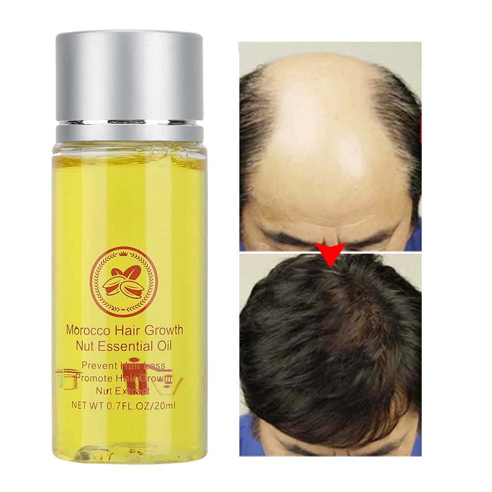 Nut Hair Growth Care Essential Oil Hair Loss Treatment Nourishing Essential Oil20ml