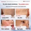 Toyo No Hana Salicylic Acid Exfoliating Pads