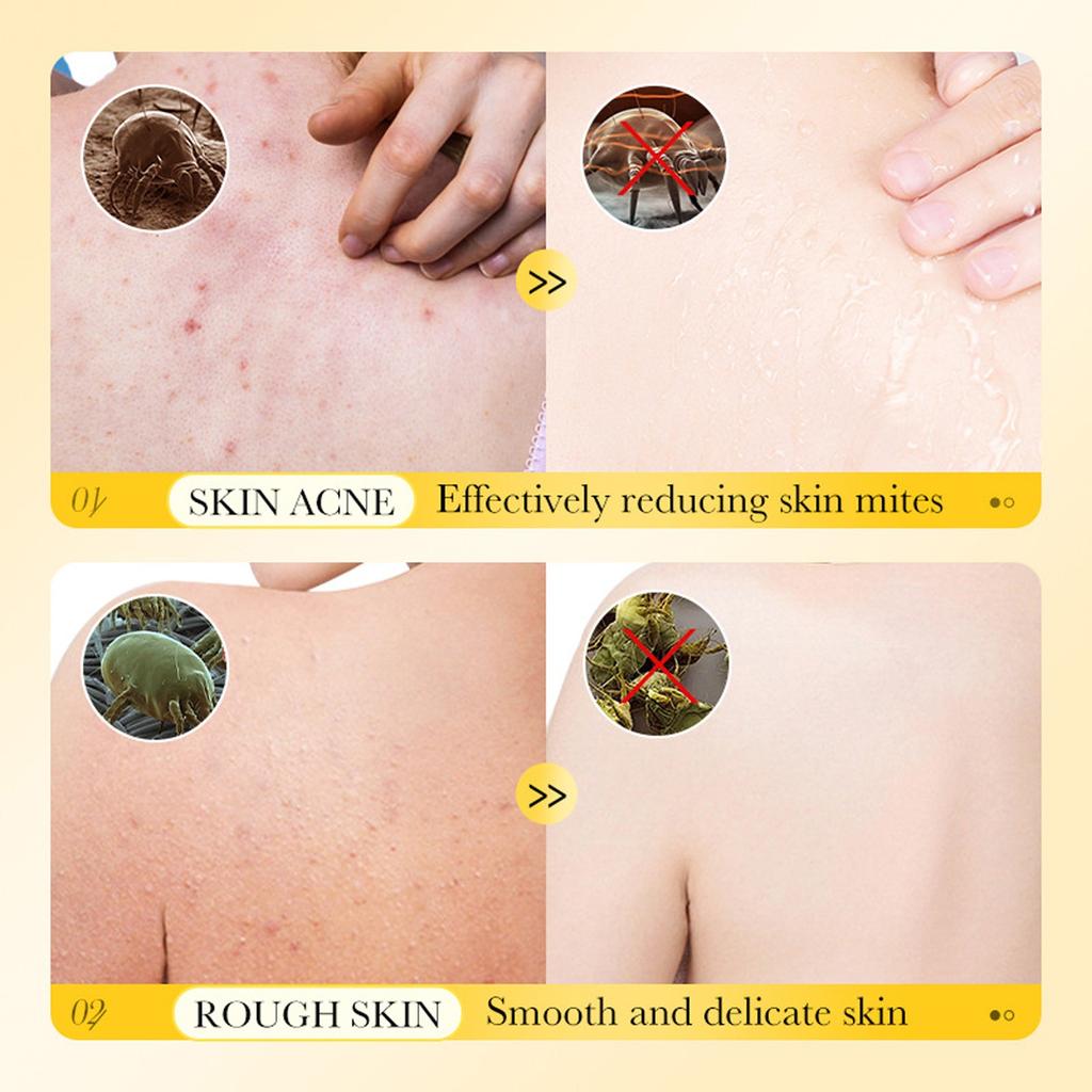 El gel de ducha antiácaros con azufre se utiliza para la picazón en la piel y puede limpiar y nutrir eficazmente la piel seca, agrietada y con picazón.