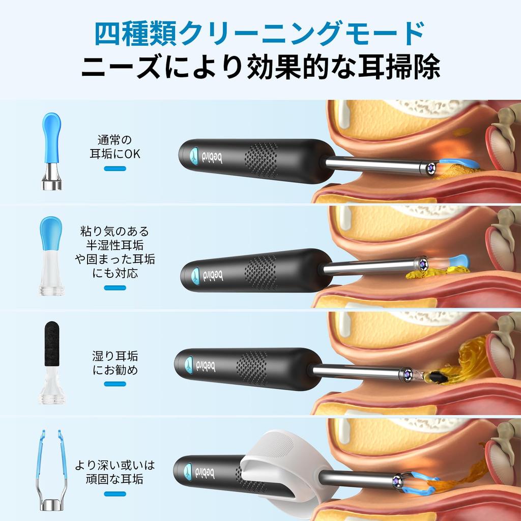 Bebird 3rd Generation R1 in Earpick 10 Megapixels Enhanced Image Quality Lens Adjustable Brightness LED Light Tweezers Included and Nose Observation