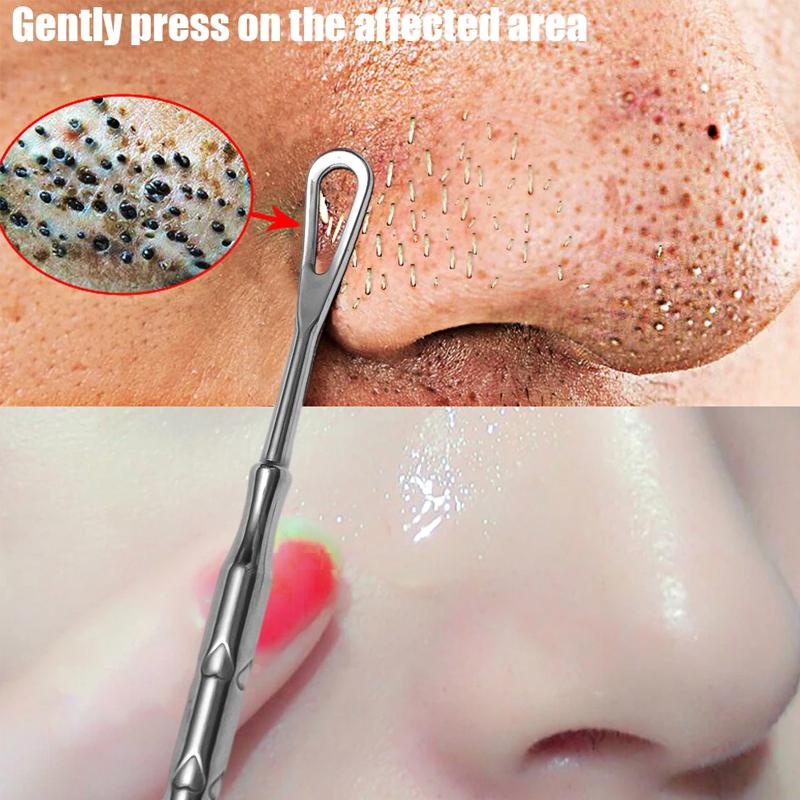 Acne Needle Blackhead Remover Pimple Popper Tool Cleaning Facial Closed Comedones Tool Acne Treatment Pore Cleanser Needle Tool