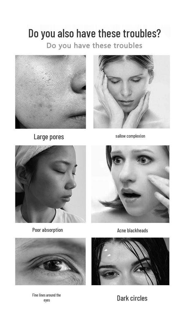 Ultrasonic Warm Facial Cleanser Brush - Silicone Pore Cleaner & Beauty Massager