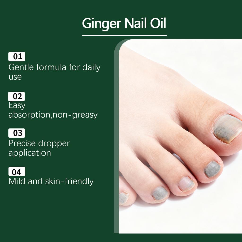 Nail Care Oil, Nail Nourishing Oil, Repairing Damaged Keratin Layer, Keratin Layer Oil,30ml