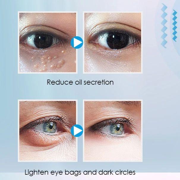 IPL Vibration Eye Massager 42℃ Constant Temperature Heating Vibration Massage Anti Wrinkle Eye Massage Pen Eye Beauty Care Devi