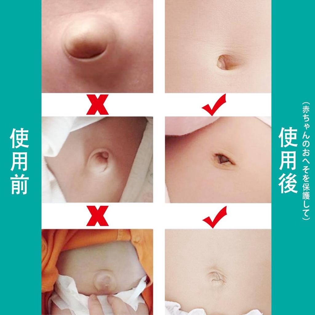 2 Pieces Baby Umbilical Hernia Belt Infant Abdomen Binder Baby Navel Truss Support Newborn Belly Belt Baby Kids Infant [Kisymear] (Pink)