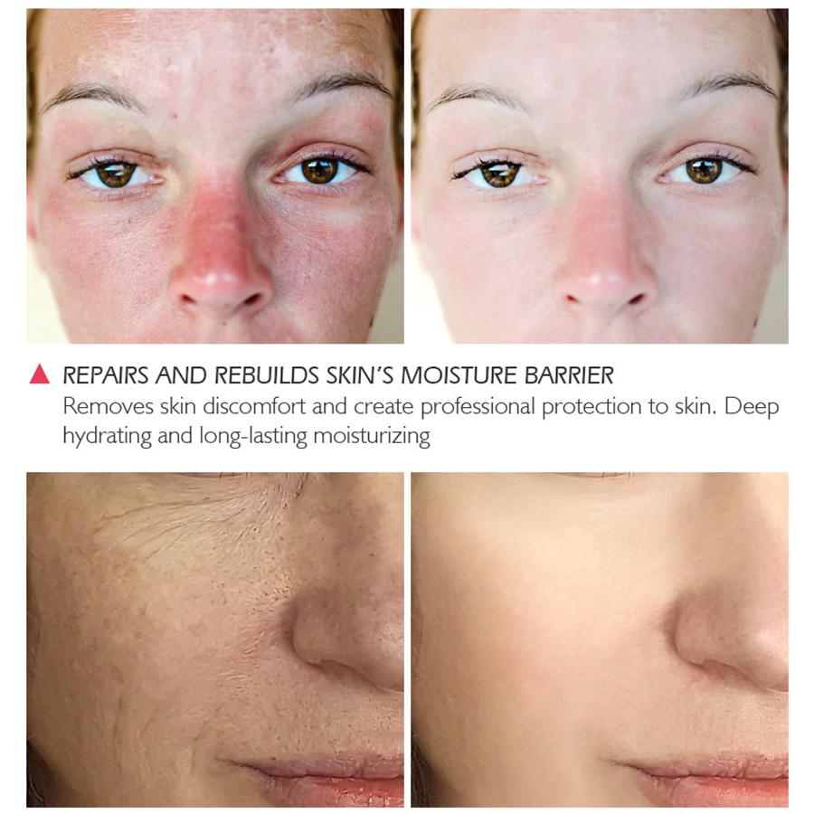 Sérum protéiné visage sérum Anti-rides Essence du visage blanchissant hydratant soins de la peau