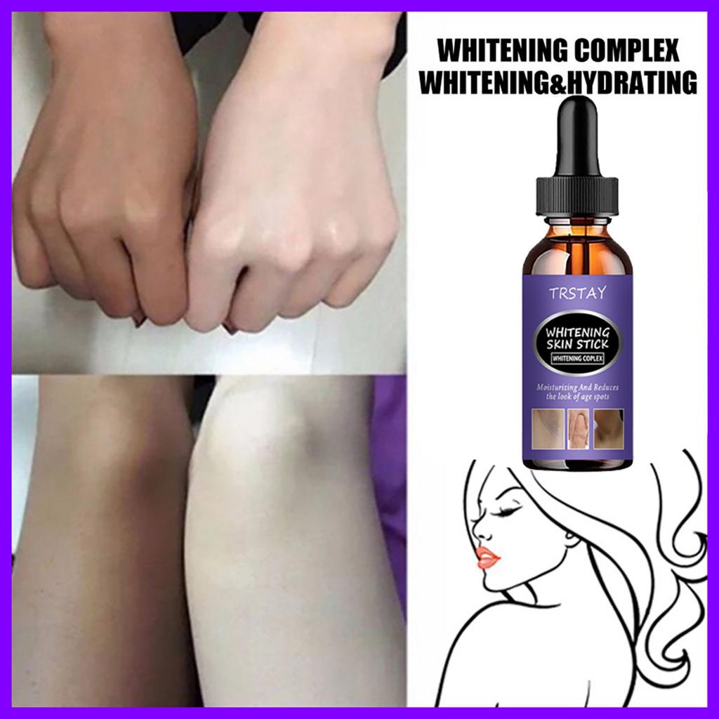 Whitening and Moisturizing Cream for Even Skin Tone and Dark Spots Reduction