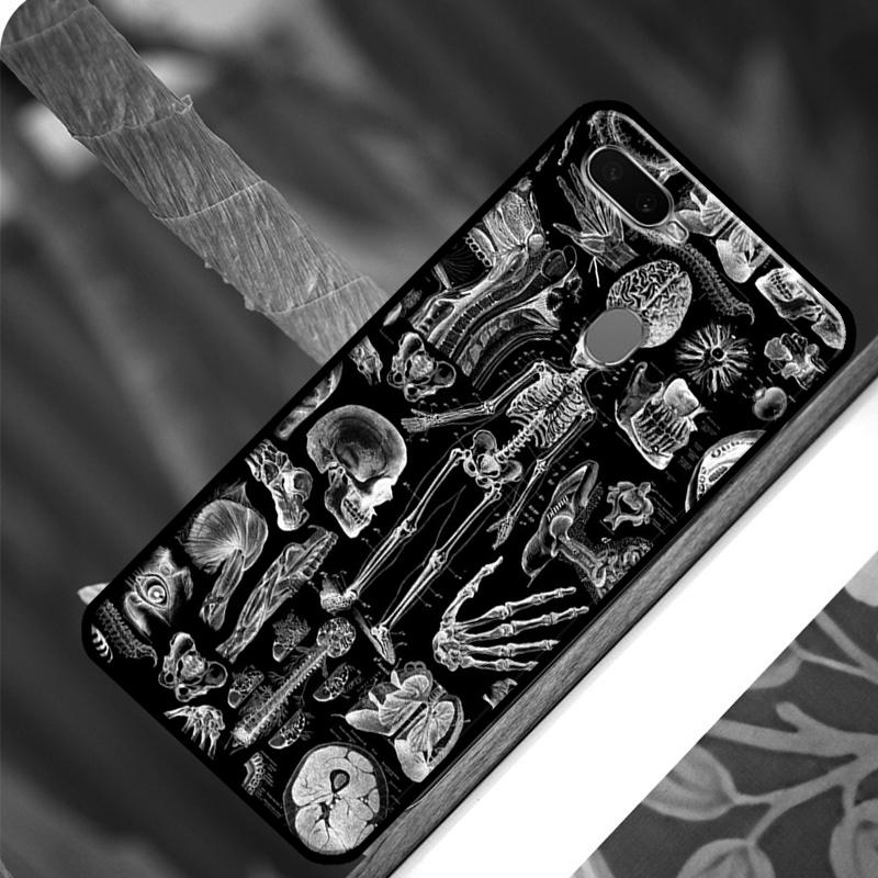 Etui na telefon z rentgenowską anatomią człowieka dla OPPO A15 A3S A5S A52 A72 A54 A74 A94 A83 A91 A93 A5 A9 A31 A53 A53S 2020