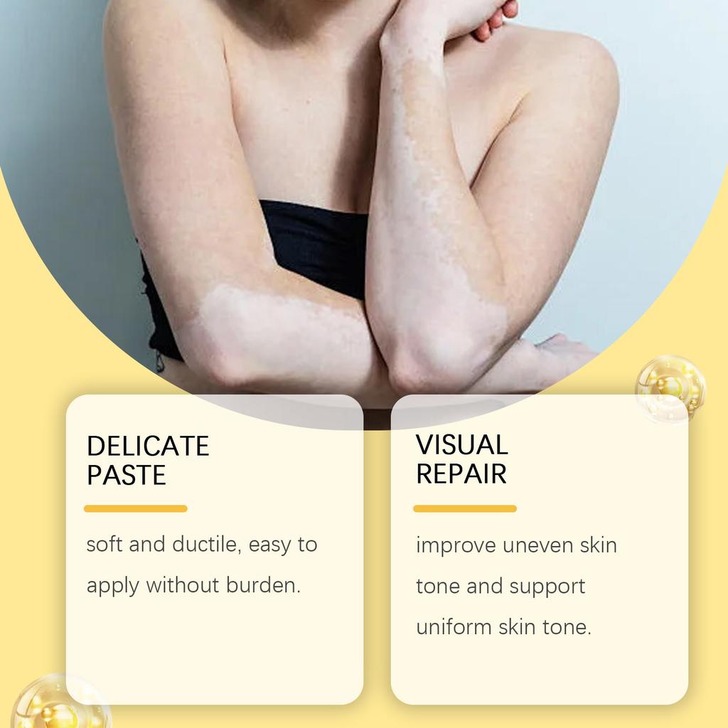 Crema Idratante e per Api, Uniforma il Tono della Pelle, Crema per la Pelle con Vitiligine, Crema per la Cura della Pelle