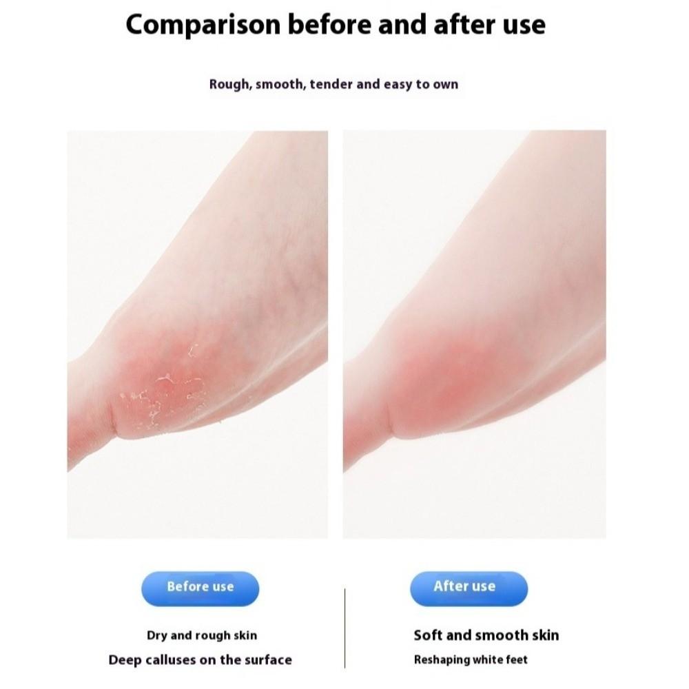 Foot File Electric Foot Grinder Digital Display Dead Skin Remover  Foot Care Grinding Pedicure Tool