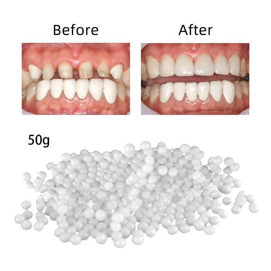 

Temporary Tooth Repair Kit Teeth Gaps FalseTeeth Solid Glue Denture Adhesive 50g
