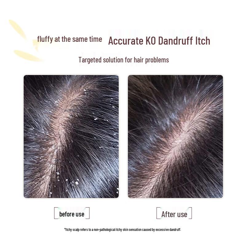 Qianxiang Anti-Dandruff Volumizing Shampoo