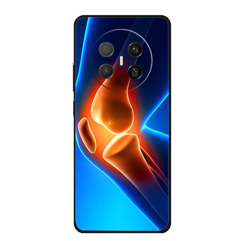 Black Silicone Case For Huawei Mate 70 Air 2025 Case Cartoon Cat Soft Back Cover For Huawei Mate 70 Air Phone Case Funda Coque