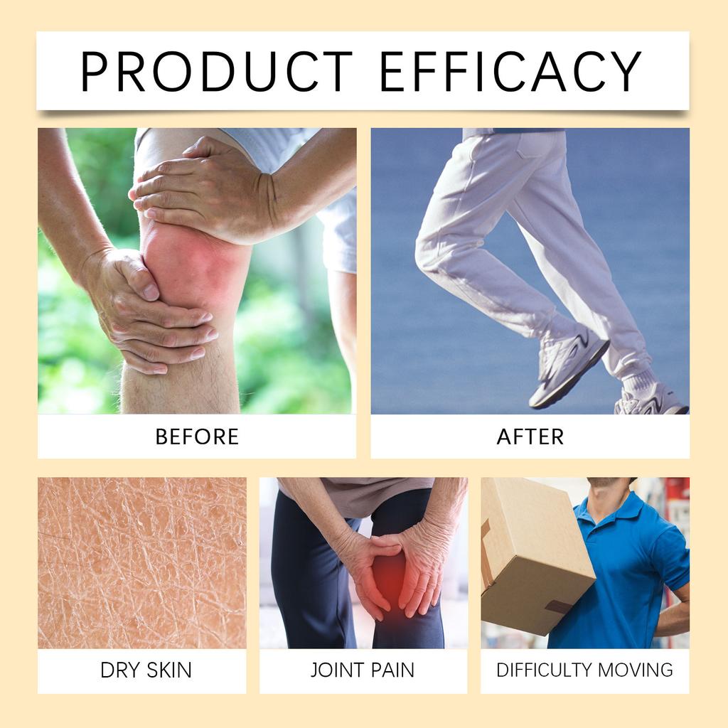 Joint Care Cream Gently Nourishes And Soothes Discomfort In Hands And Feet. Portable Massage, External Application Care Cream.