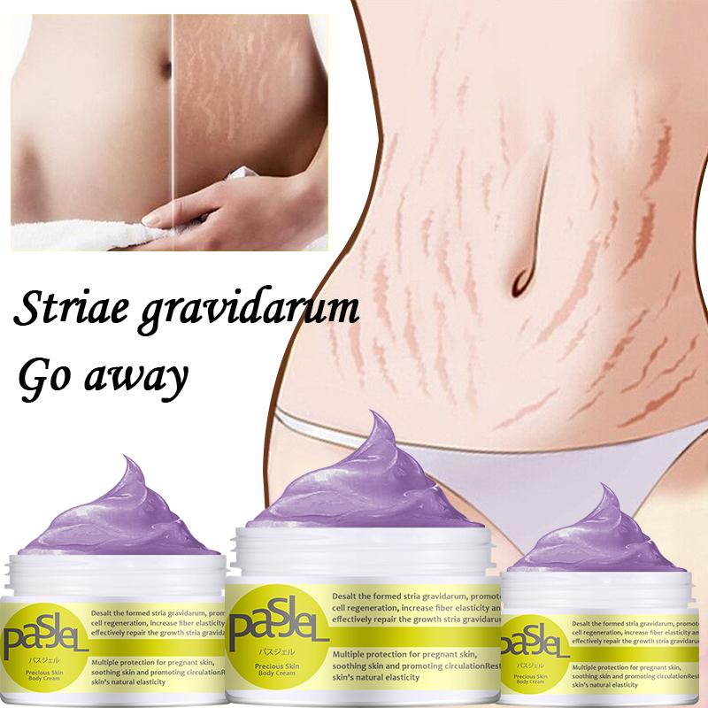 Mometry Cream Buy Maternity Stretch Marks Removal Cream Body Buttock Breast Mark Skin ...