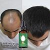 Natural Extract Baldness Repair Spray Hair Regrowth Lotion Haircare Hair Loss Oil