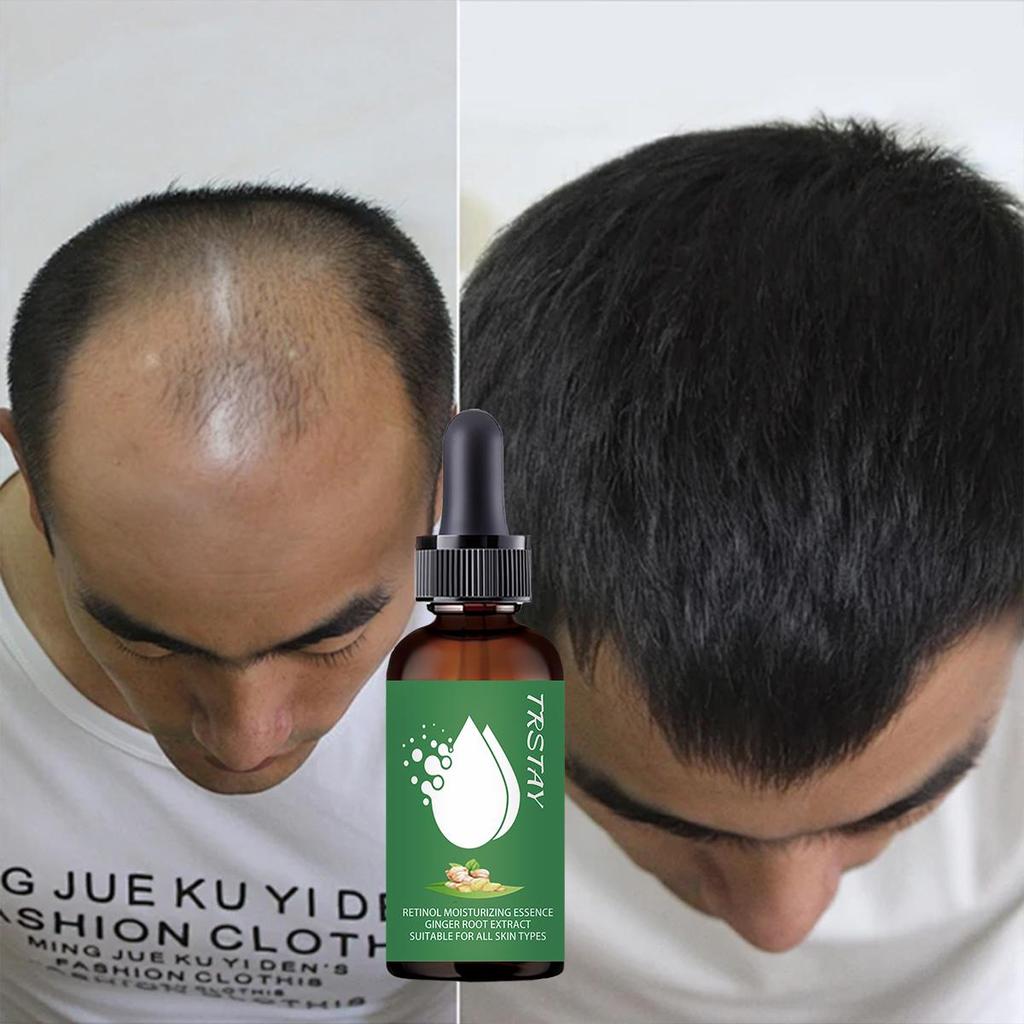 Natural Extract Baldness Repair Spray Hair Regrowth Lotion Haircare Hair Loss Oil