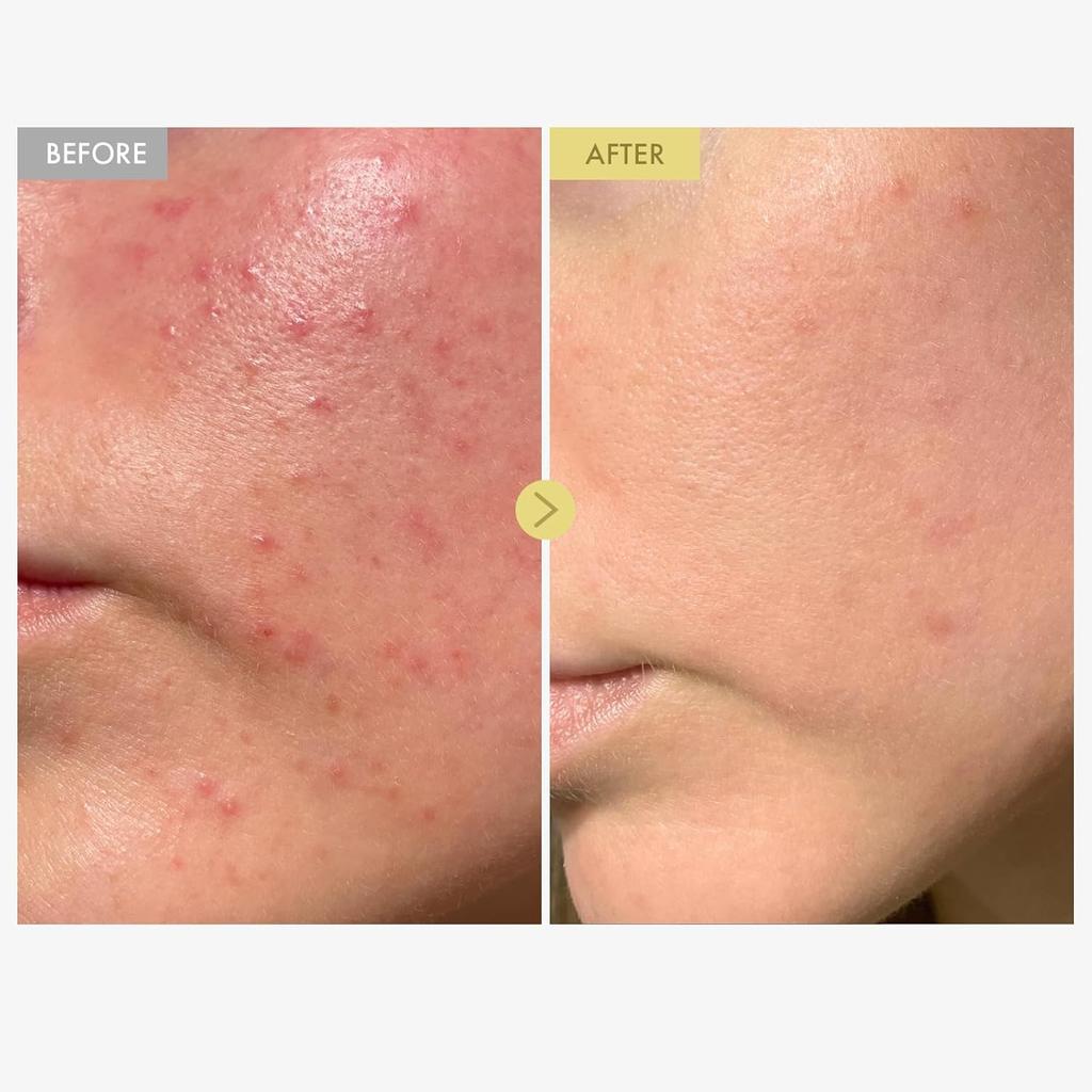 TOSOWOONG Black Snail Mucin Cream 100ml