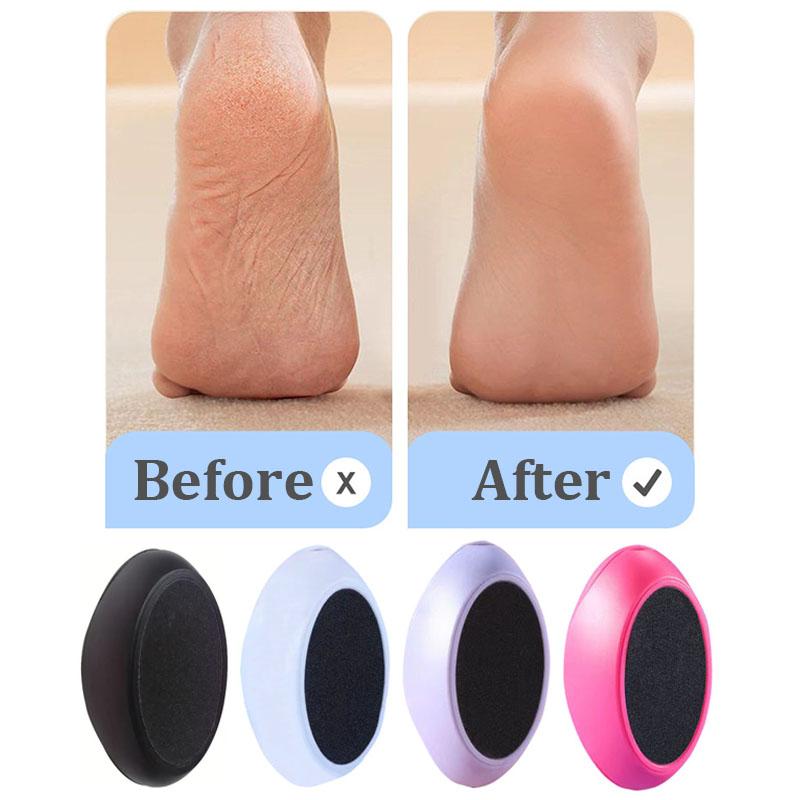 1 Stück Pediküre Fußpflege Werkzeug Fußfeile Peeling Hornhaut Nagelhautentferner Heimgebrauch Edelstahl Massagepflege Ovale Eiform