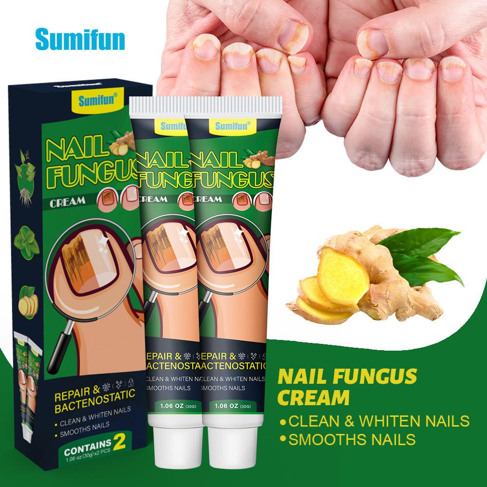 Sumifun Nail Care Ointment With Soothing Formula For Foot And Hand Maintenance