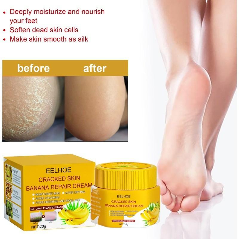 Eelhoe Skin Crack Banana Repair Cream Nourishing Foot Cream For Dry Cracked Skin