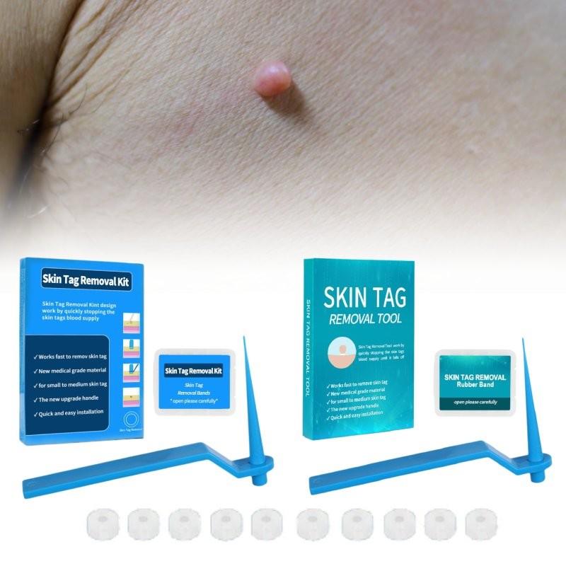 Effective Skin Tag Removal Tag Refill Band Set With 10 Pieces For Smooth Skin