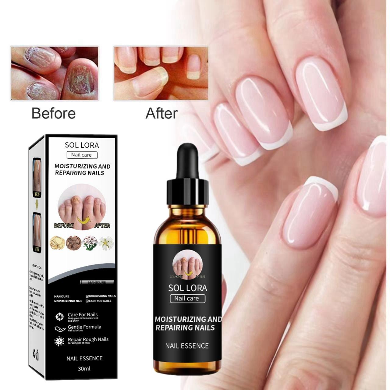 

Nail Repair Solution Thickening, Brightening, Moisturizing for Nail Care