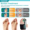 Durable And Safe 1Pcs Bunion Toe Corrector Splint For Women & Men Adjustable Bunion Straightener For Pain Relief Big Toe Orthopedic Separator