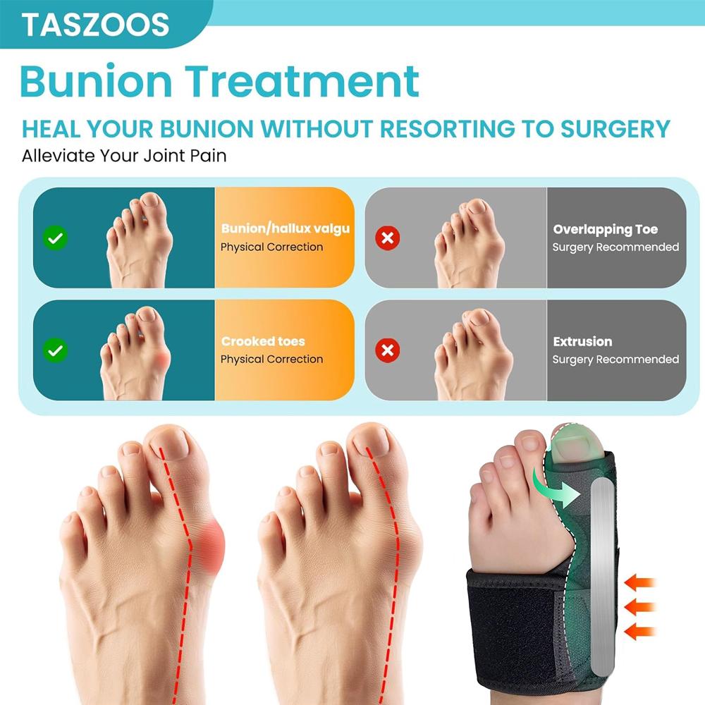 Durable And Safe 1Pcs Bunion Toe Corrector Splint For Women & Men Adjustable Bunion Straightener For Pain Relief Big Toe Orthopedic Separator