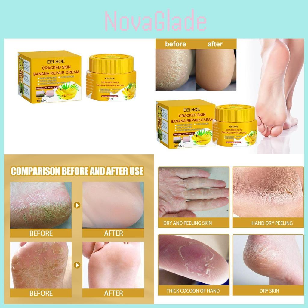 Eelhoe Skin Crack Banana Repair Cream Nourishing Foot Cream For Dry Cracked Skin