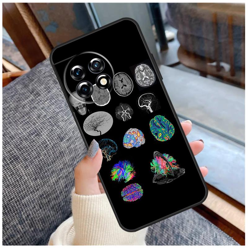 Medical Human Organs Brain Case For OnePlus 15 12R 13R 13T 10T 8T 13 12 11 10 Pro Nord 5 CE 2 3 4 Lite N20 N30 Coque
