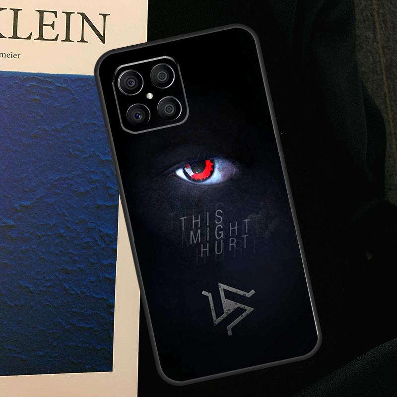 Teen Wolf Beacon Hills Case For Honor X9b X9c X8b X9a X8a X8 X9 50 70 90 Lite Honor 200 Pro Magic 7 5 6 Lite Cover