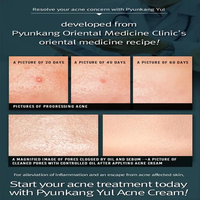 [Pyunkang Yul] ACNE Cream 50ml