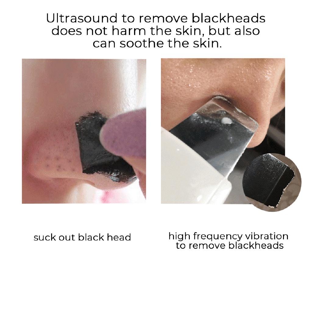 Ultrasonic Skin Scruber Portable Face Cleanser Massager Deep Cleaning Dead Skin Removal Beauty Machine USB Charging