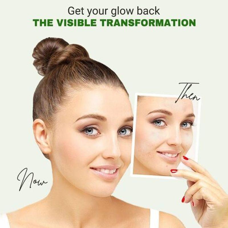 [Beauty of Joseon] Light On Serum : Centella + Vita C 30ml