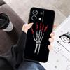 Lightning Bones Cover For Xiaomi Redmi Note 13 9 10 11 12 14 15 Pro Plus Case For Redmi 15 C 12C 13C 14C 10C