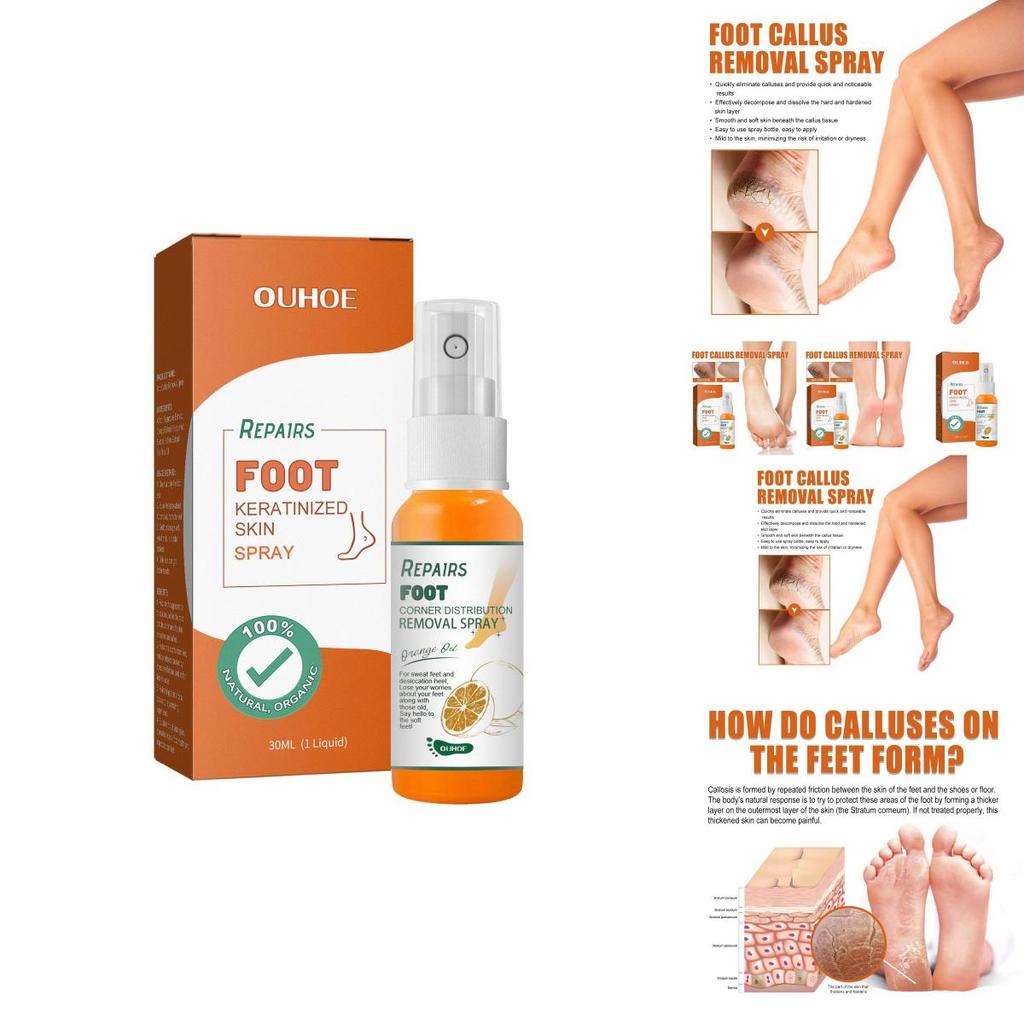 Nourishing Ouhoe Foot Spray For Softening Calluses And Cracked Heels 30ml