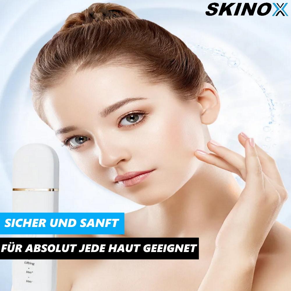 SKINOX Ultraschall Hautreiniger Gesichtsreinigungsbürste Gesichtsreiniger Bürste