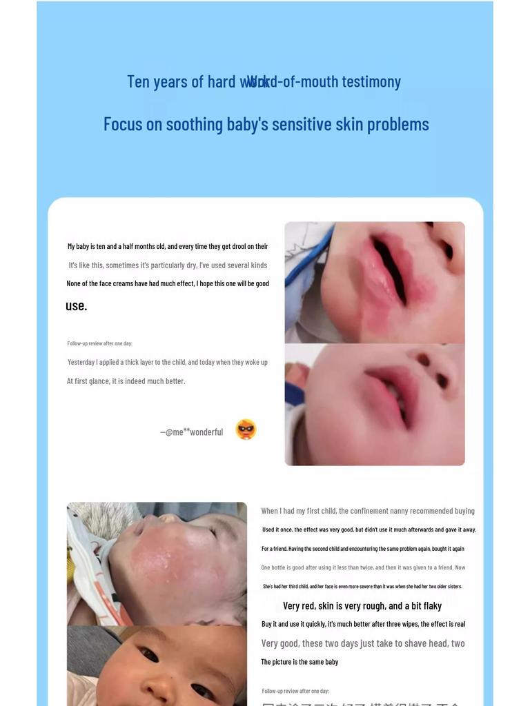 Jiezhi Bebek Hassas Cilt Kremi - Kaşıntılı, Kızarık Cildi Yatıştırır, Bebekler İçin Nemlendirir ve Korur 0-6 Ay